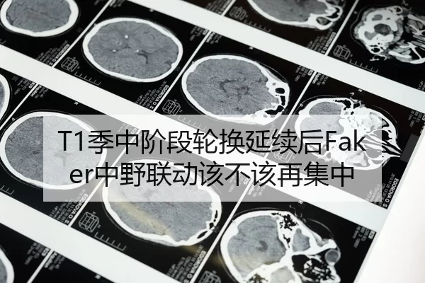 T1季中阶段轮换延续后Faker中野联动该不该再集中